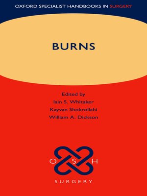cover image of Burns